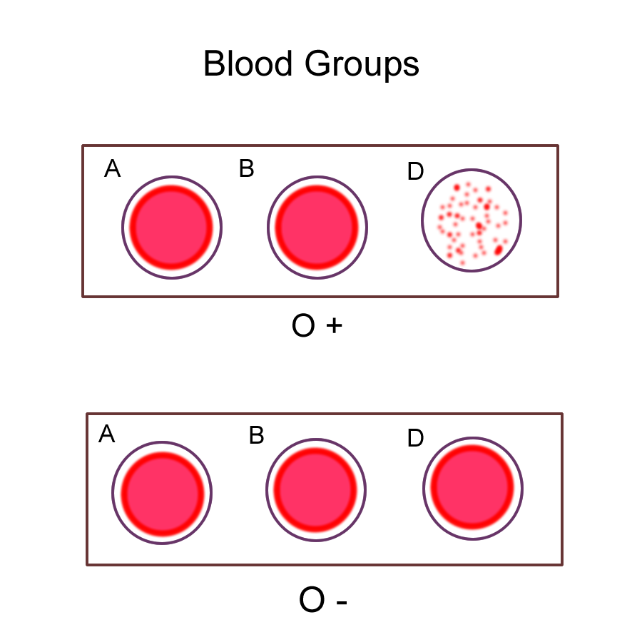 Rh blood type